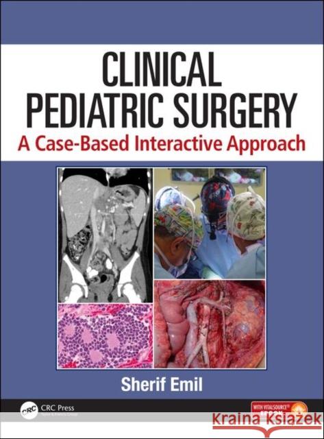 Clinical Pediatric Surgery: A Case-Based Interactive Approach [With eBook] Emil, Sherif 9781498710336 Productivity Press - książka