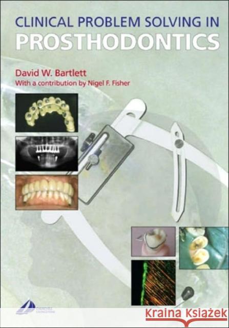 Clinical Problem Solving in Prosthodontics David W. Bartlett Nigel F. Fisher 9780443072826 Churchill Livingstone - książka