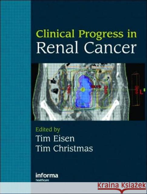 Clinical Progress in Renal Cancer Timothy Eisen Timothy Christmas 9781841846040 Informa Healthcare - książka