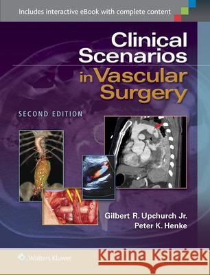 Clinical Scenarios in Vascular Surgery Gilbert R Upchurch 9781451192131 LIPPINCOTT WILLIAMS & WILKINS - książka