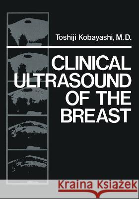Clinical Ultrasound of the Breast Toshiji Kobayashi   9781461339878 Springer - książka