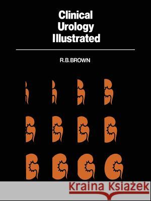 Clinical Urology Illustrated R. B. Brown 9789400980983 Springer - książka
