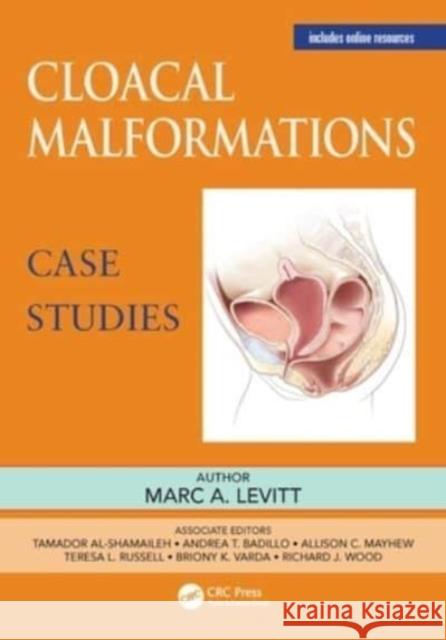 Cloacal Malformations: Case Studies  9781032215471  - książka