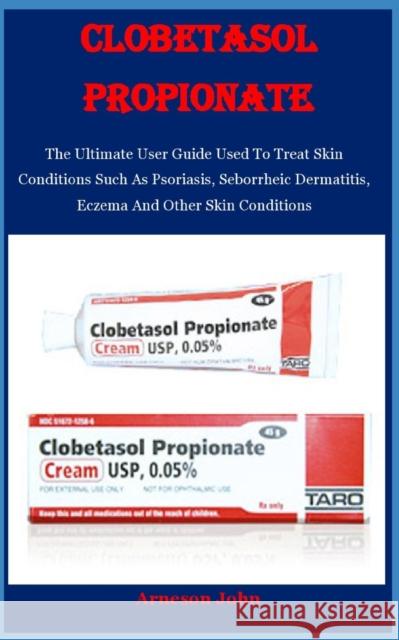 Clobetasol Propionate: The Ultimate User Guide Used To Treat Skin Conditions Such As Psoriasis, Seborrheic Dermatitis, Eczema And Other Skin Arneson John 9781326557775 Lulu.com - książka
