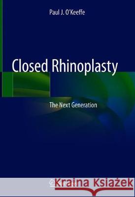 Closed Rhinoplasty: The Next Generation O'Keeffe, Paul J. 9783030168513 Springer - książka