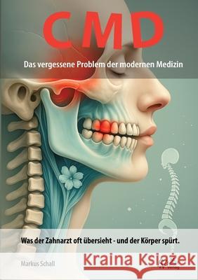 CMD - Das vergessene Problem der modernen Medizin: Was der Zahnarzt oft ?bersieht - und der K?rper sp?rt. Markus Schall 9783819201578 Bod - Books on Demand - książka
