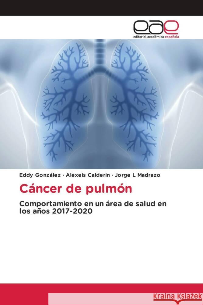 Cáncer de pulmón González, Eddy, Calderon, Alexeis, Madrazo, Jorge L 9783659087639 Editorial Académica Española - książka