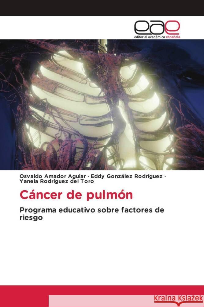 Cáncer de pulmón Amador Aguiar, Osvaldo, González Rodríguez, Eddy, Rodríguez del Toro, Yanela 9786138983613 Editorial Académica Española - książka