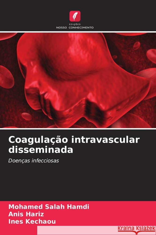 Coagula??o intravascular disseminada Mohamed Salah Hamdi Anis Hariz Ines Kechaou 9786206898368 Edicoes Nosso Conhecimento - książka