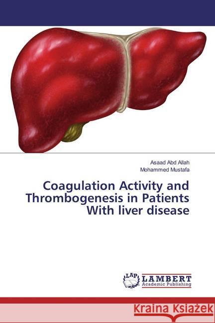 Coagulation Activity and Thrombogenesis in Patients With liver disease Abd Allah, Asaad; Mustafa, Mohammed 9783659828737 LAP Lambert Academic Publishing - książka