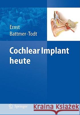 Cochlear Implant Heute Ernst, Arne 9783540882350 Springer - książka