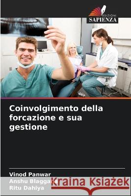 Coinvolgimento della forcazione e sua gestione Vinod Panwar Anshu Blaggana Ritu Dahiya 9786205229156 Edizioni Sapienza - książka