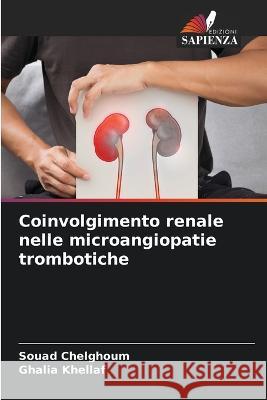 Coinvolgimento renale nelle microangiopatie trombotiche Souad Chelghoum Ghalia Khellaf 9786205806142 Edizioni Sapienza - książka