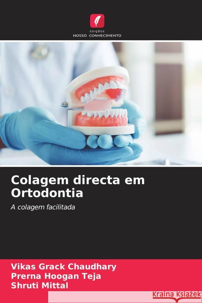 Colagem directa em Ortodontia Chaudhary, Vikas Grack, Teja, Prerna Hoogan, Mittal, Shruti 9786205222430 Edições Nosso Conhecimento - książka