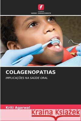 COLAGENOPATIAS Agarwal, Kriti 9786209081088 Edições Nosso Conhecimento - książka
