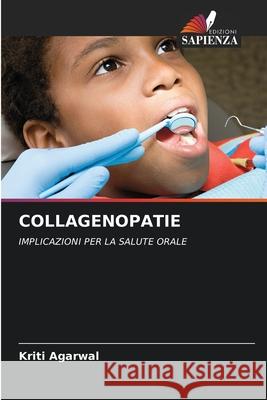 COLLAGENOPATIE Agarwal, Kriti 9786209106682 Edizioni Sapienza - książka