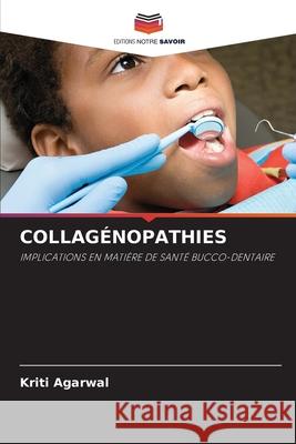 COLLAGÉNOPATHIES Agarwal, Kriti 9786209101557 Editions Notre Savoir - książka
