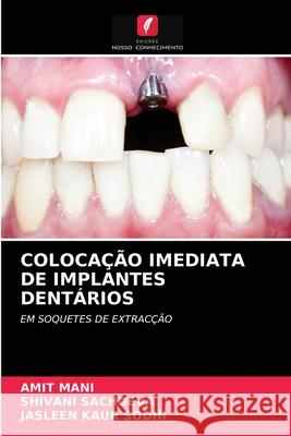 Colocação Imediata de Implantes Dentários Amit Mani, Shivani Sachdeva, Jasleen Kaur Sodhi 9786203216523 Edicoes Nosso Conhecimento - książka