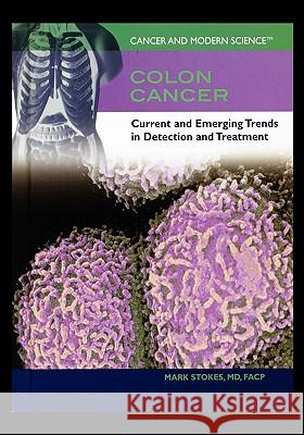 Colon Cancer: Current and Emerging Trends in Detection and Treatment Mark Stokes 9781435837423 Rosen Publishing Group - książka