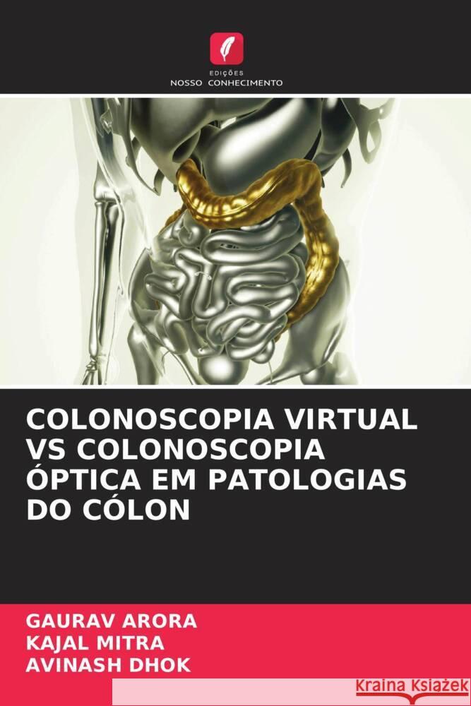 COLONOSCOPIA VIRTUAL VS COLONOSCOPIA ÓPTICA EM PATOLOGIAS DO CÓLON Arora, Gaurav, Mitra, Kajal, Dhok, Avinash 9786204773216 Edições Nosso Conhecimento - książka