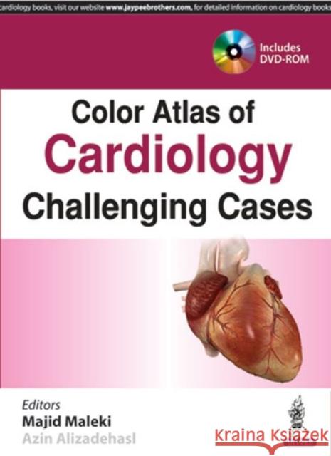 Color Atlas of Cardiology: Challenging Cases Majid Maleki 9789386322142 Jaypee Brothers, Medical Publishers Pvt. Ltd. - książka