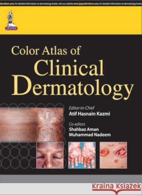 Color Atlas of Clinical Dermatology Atif Hasnain Kazmi Shahbaz Aman Muhammad Nadeem 9789351526278 Jaypee Brothers Medical Publishers - książka