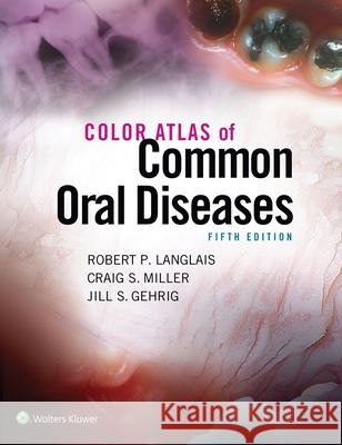 Color Atlas of Common Oral Diseases Robert P. Langlais 9781496332080 Wolters Kluwer Law & Business - książka