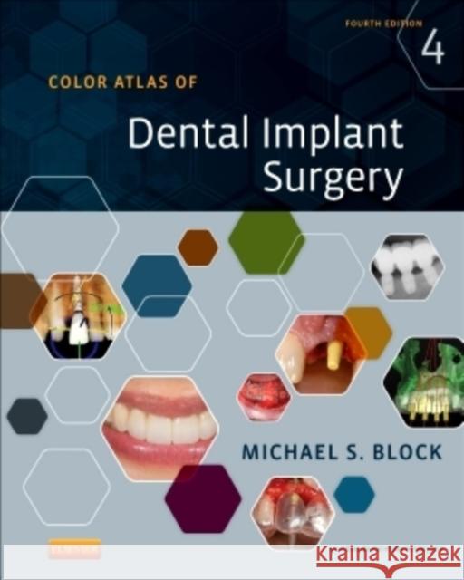 Color Atlas of Dental Implant Surgery Michael S. Block 9781455759682 W.B. Saunders Company - książka