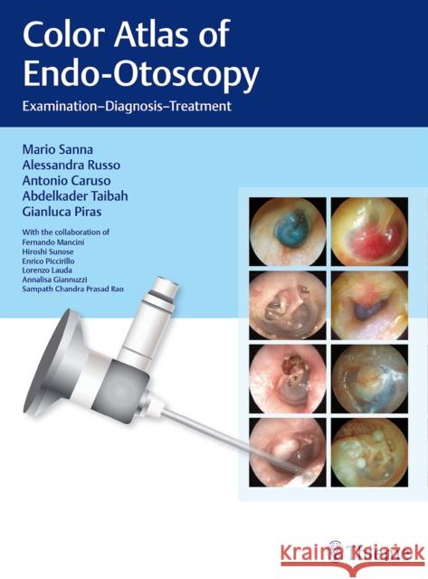 Color Atlas of Endo-Otoscopy: Examination-Diagnosis-Treatment Sanna, Mario 9783132415232 Tps - książka