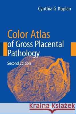Color Atlas of Gross Placental Pathology Cynthia G. Kaplan 9780387338422 Springer - książka