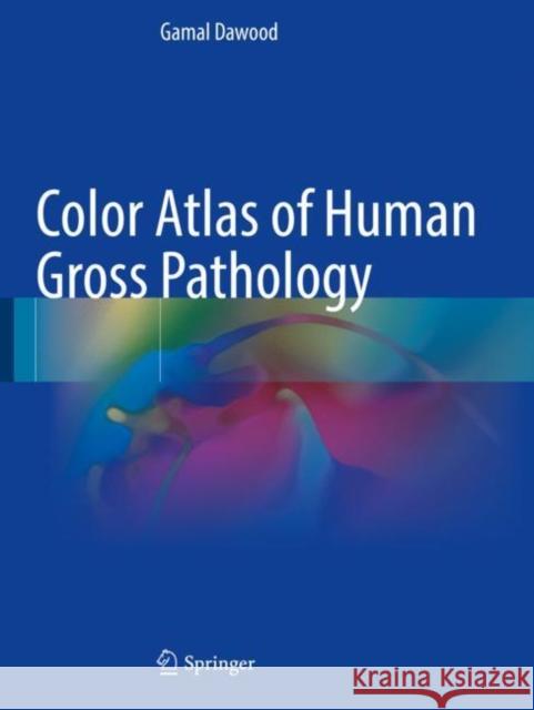 Color Atlas of Human Gross Pathology Gamal Dawood 9783030913175 Springer - książka