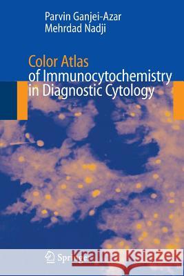 Color Atlas of Immunocytochemistry in Diagnostic Cytology Parvin Ganjei-Azar Mehrdad Nadji 9780387321219 Springer - książka
