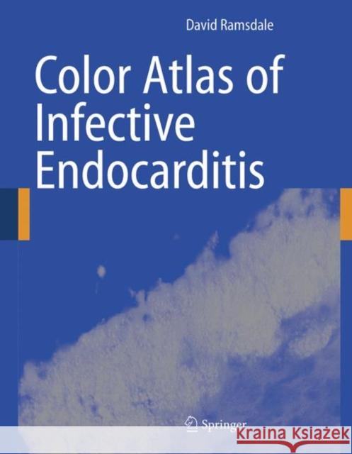 Color Atlas of Infective Endocarditis David R. Ramsdale 9781852339371 Springer - książka