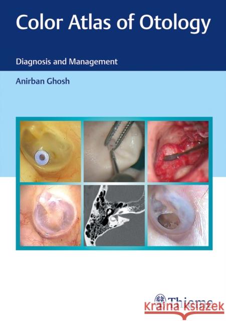 Color Atlas of Otology: Diagnosis and Management Ghosh, Anirban 9789390553761 Thieme, Stuttgart - książka