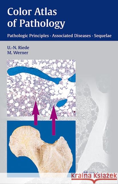 Color Atlas of Pathology: Pathologic Principles, Associated Diseases, Sequela Riede, Urs-Nikolaus 9783131277817  - książka
