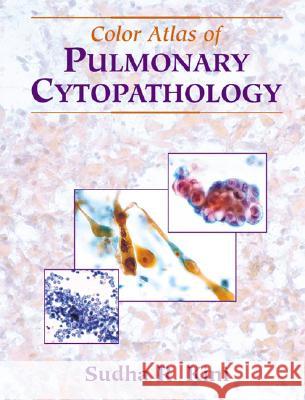 Color Atlas of Pulmonary Cytopathology Kini, Sudha R. 9780387953717 Springer - książka