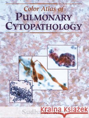 Color Atlas of Pulmonary Cytopathology Sudha R Kini 9781441929778  - książka