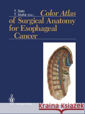 Color Atlas of Surgical Anatomy for Esophageal Cancer Tatsuo Sato Toshifumi Iizuka 9784431682004 Springer - książka