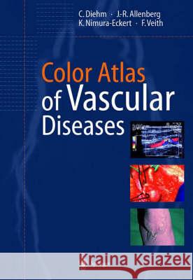 Color Atlas of Vascular Diseases Curt Diehm Jens-Rainer Allenberg Keiko Nimura-Eckert 9783540626190 Springer Berlin Heidelberg - książka