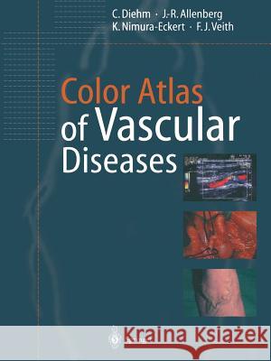 Color Atlas of Vascular Diseases C. Diehm J. -R Allenberg K. Nimura-Eckert 9783642082962 Not Avail - książka