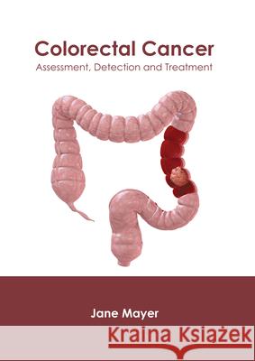 Colorectal Cancer: Assessment, Detection and Treatment Jane Mayer 9781632429285 Foster Academics - książka