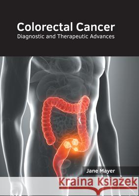 Colorectal Cancer: Diagnostic and Therapeutic Advances Jane Mayer 9781632418746 Hayle Medical - książka