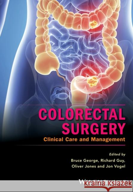 Colorectal Surgery: Clinical Care and Management  9781118674789 John Wiley & Sons - książka