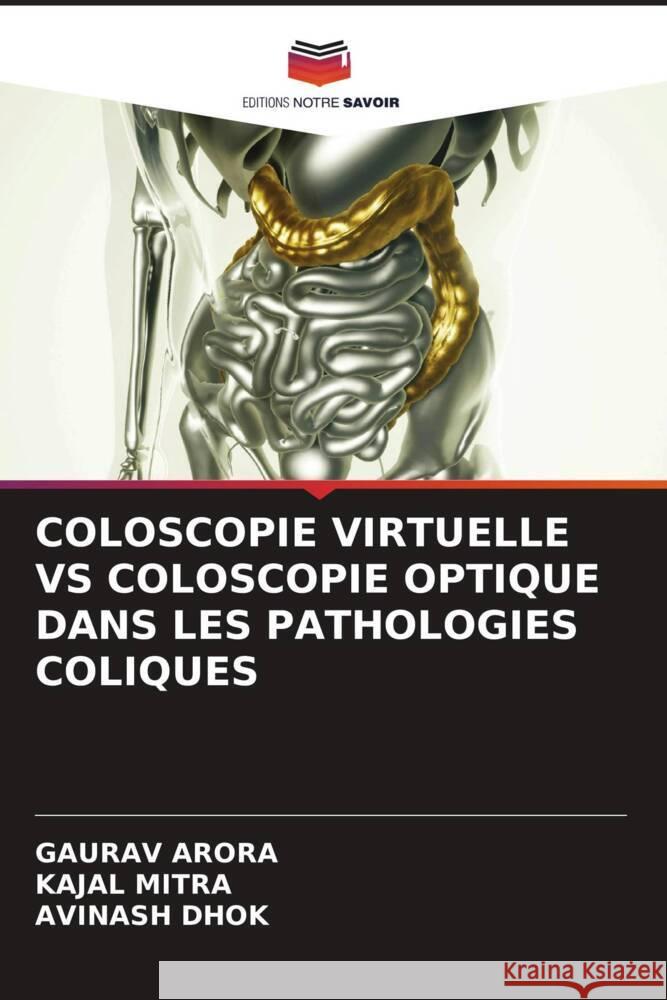 COLOSCOPIE VIRTUELLE VS COLOSCOPIE OPTIQUE DANS LES PATHOLOGIES COLIQUES Arora, Gaurav, Mitra, Kajal, Dhok, Avinash 9786204773193 Editions Notre Savoir - książka