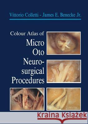 Colour Atlas of Micro-Oto-Neurosurgical Procedures Vittorio Colletti James E. Jr. Benecke William F. House 9781447137917 Springer - książka