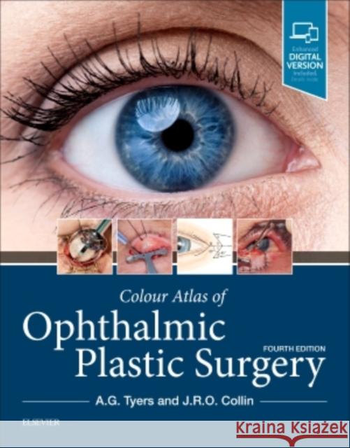 Colour Atlas of Ophthalmic Plastic Surgery J. R. O., MA, MB, Bchir, FRCS, FRCOphth, DO (Consultant Ophthalmic Surgeon, Moorfields Eye Hospital and Institute of Oph 9780323476799 Elsevier - Health Sciences Division - książka