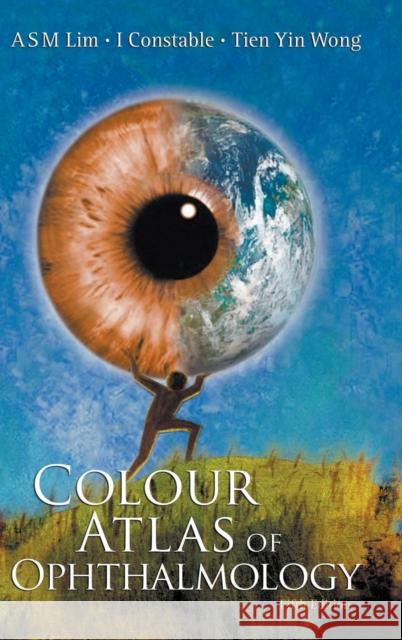 Colour Atlas of Ophthalmology (Fifth Edition) Arthur Sm Lim                            Tien Yin Wong                            Arthur Siew Ming Lim 9789812771544 World Scientific Publishing Company - książka