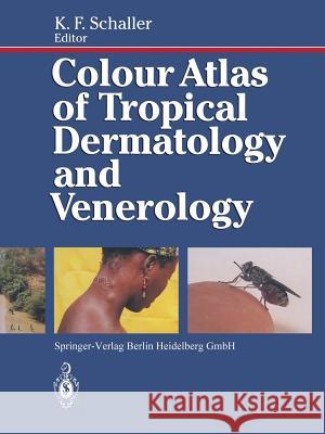 Colour Atlas of Tropical Dermatology and Venerology F. F. Weyer Karl F. Schaller 9783642762024 Springer - książka
