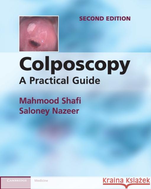 Colposcopy Shafi, Mahmood 9781107667822  - książka