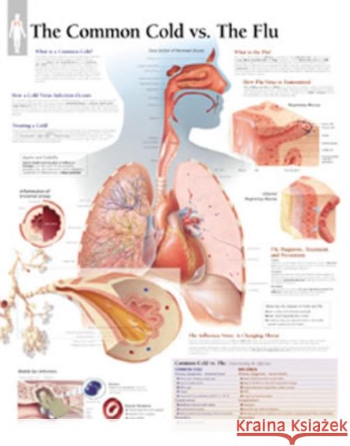 Common Cold vs the Flu Paper Poster Scientific Publishing 9781930633780 Scientific Publishing Limited - książka